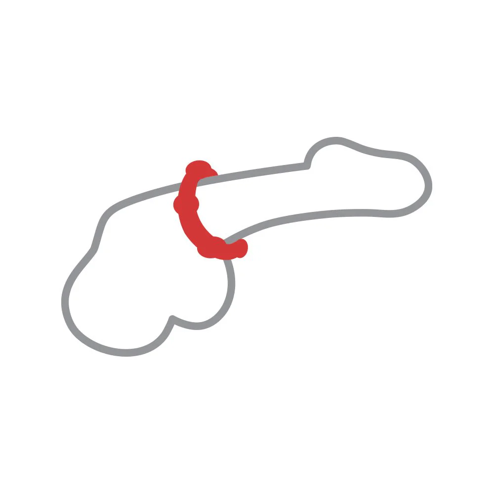 RingMaster Stretchy Bead Silicone Ring - Image 4